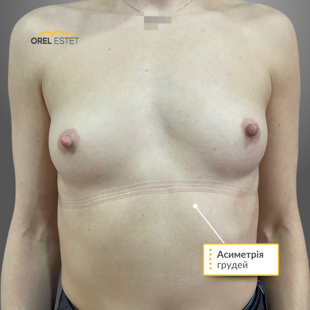 Результат