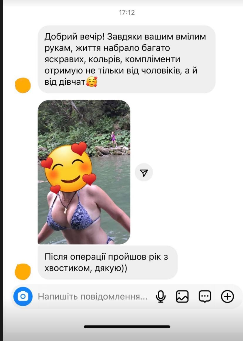 Відгук