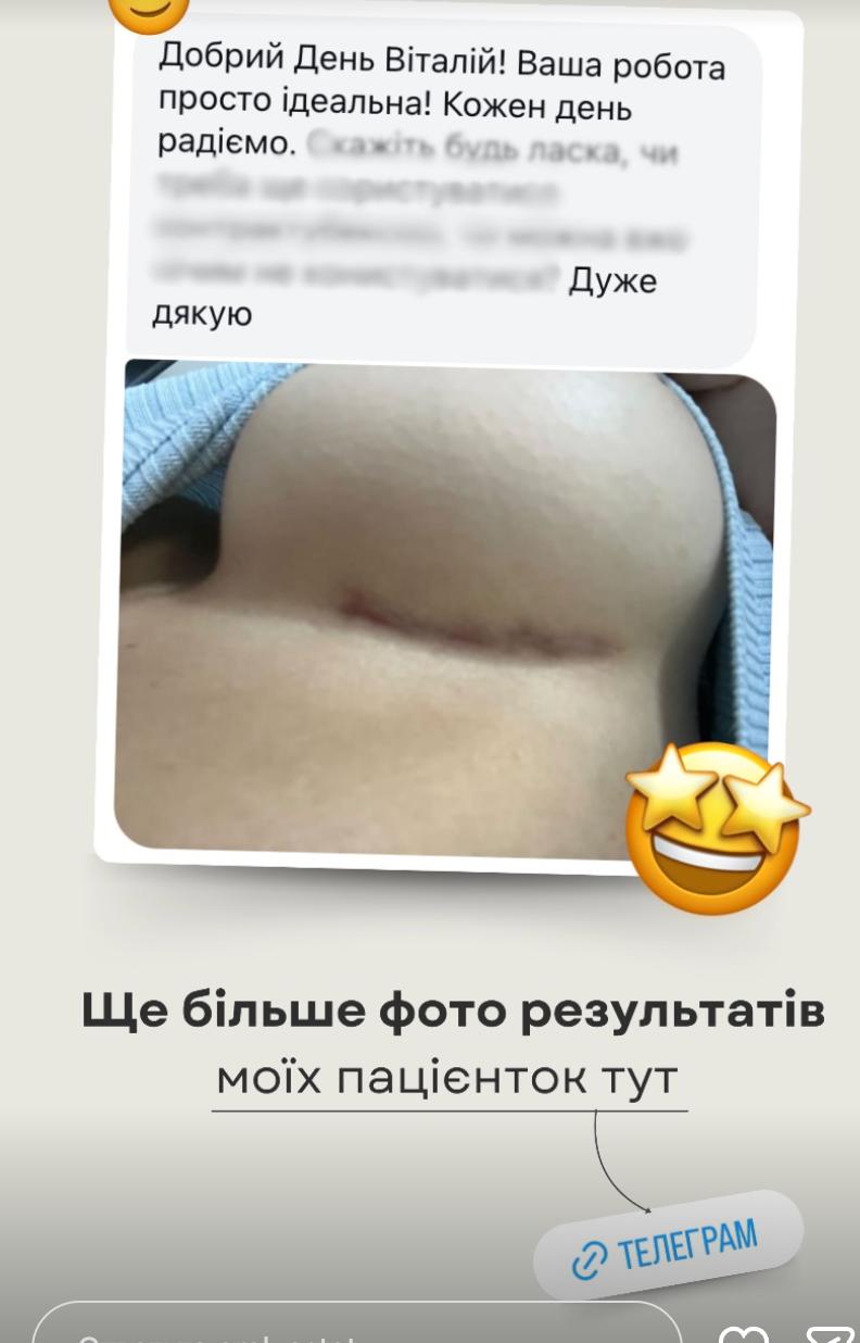 Відгук